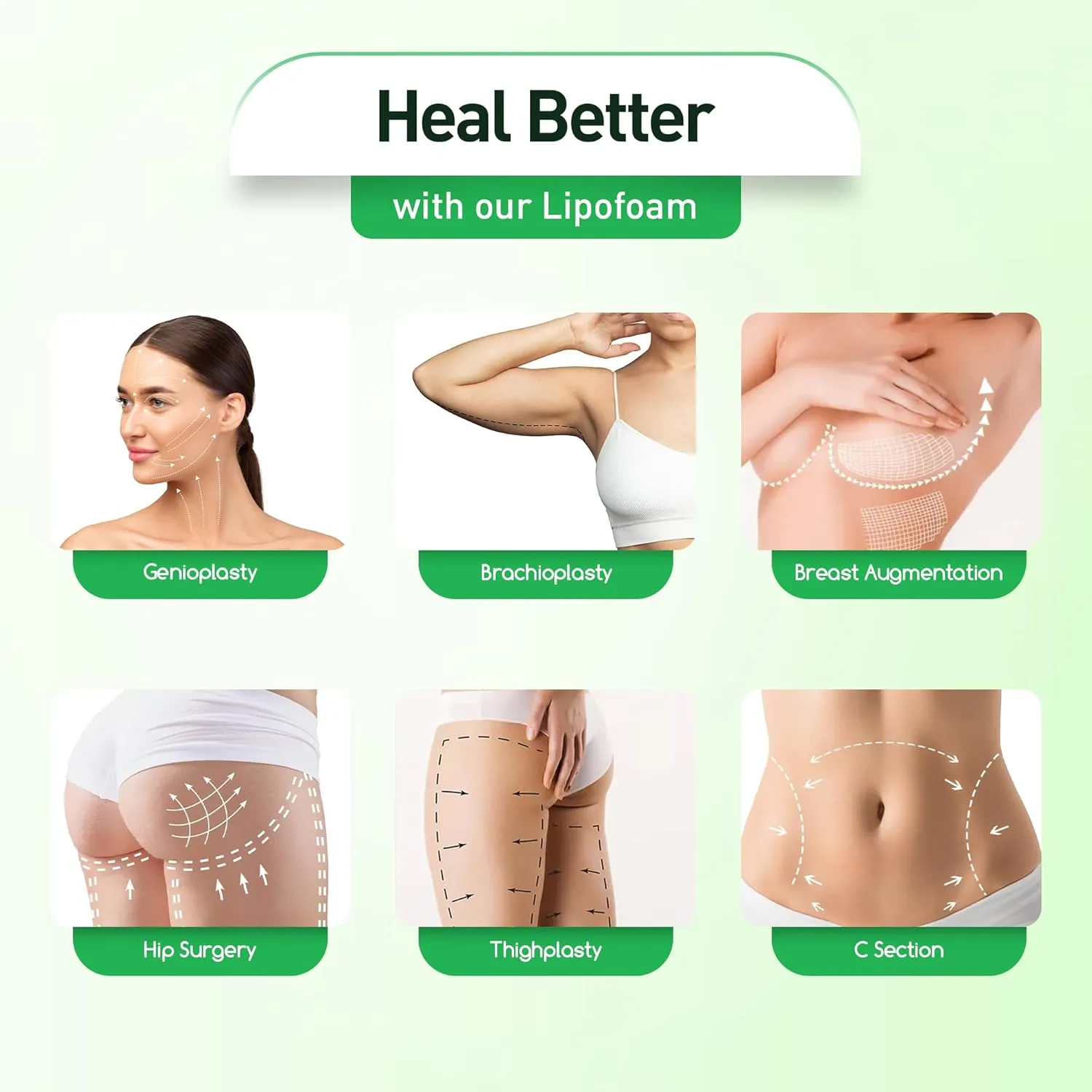 5 Pack Lipo Foam Pads - Post Surgery Ab Board for Liposuction Recovery, Flattening Abdominal Compression Garments for Tummy Tuck Surgery (8 x 11 x 0.5)